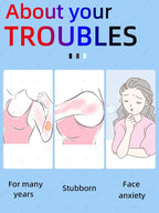 A desaparecimento da cicatriz não é um sonho